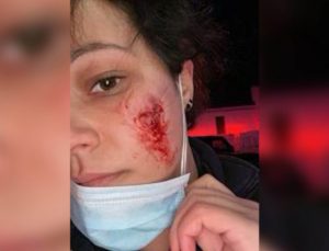New York’ta hasta, sağlık görevlisinin yüzünü ısırdı