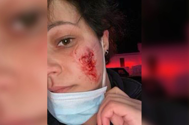 New York’ta hasta, sağlık görevlisinin yüzünü ısırdı