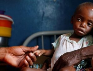 Nijerya’da yetersiz beslenme nedeniyle 81 çocuk yaşamını yitirdi