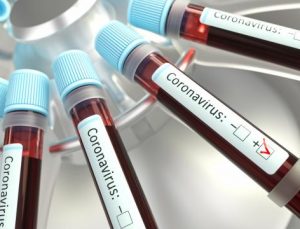 Hidroksiklorokin ilacı koronavirüs tedavisinde kullanılmayacak