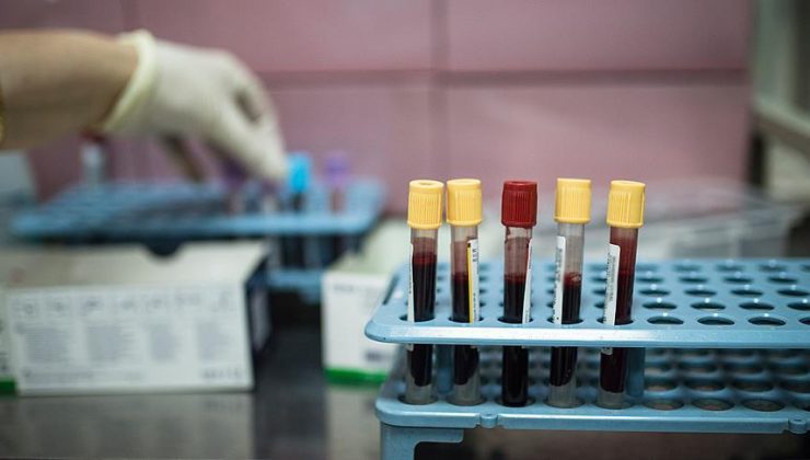 Kan testi ile kanser türü tespit etme denemeleri başlıyor