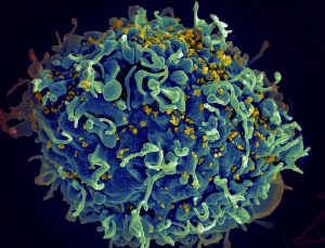 FDA, dünyanın ilk enjekte edilebilir HIV ilacını onayladı