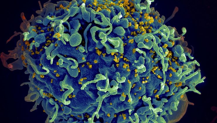 FDA, dünyanın ilk enjekte edilebilir HIV ilacını onayladı