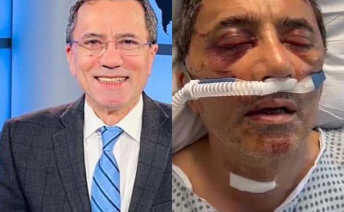 Günaz.TV’nin Genel Yayın Yönetmeni Ahmed Obalı ABD’de saldırıya uğradı!