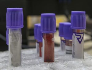 İngiltere’de denenen kan testiyle her üç kanserden ikisi tespit edildi