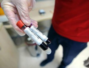 ABD’de PFAS kan testine erişim için mevzuat genişliyor