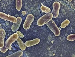 ABD ve Kanada’da salmonella salgını 8 kişinin ölümüne yol açtı