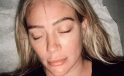 Dördüncü kez anne olmaya hazırlanan Hilary Duff akapunktur deneyimini paylaştı